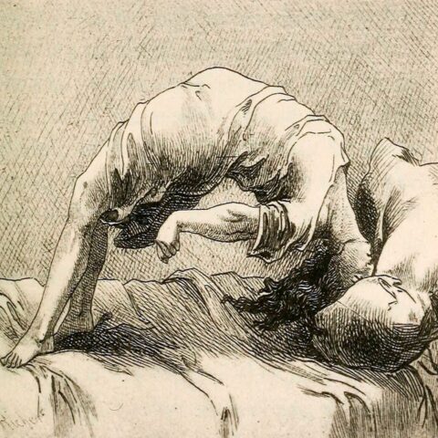 Font de la imatge en domini públic:I mage from page 144 of "Hysteria and certain allied conditions, their nature and treatment, with special reference to the application of the rest cure, massage, electrotherapy, hypnotism, etc" (1897)